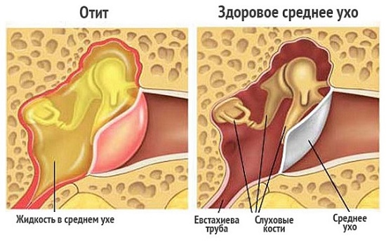 Как проверить болит ли у грудничка ухо thumbnail