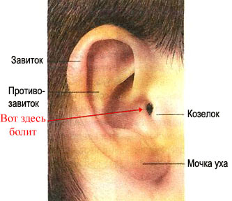 как проверить болят ли уши у младенца thumbnail